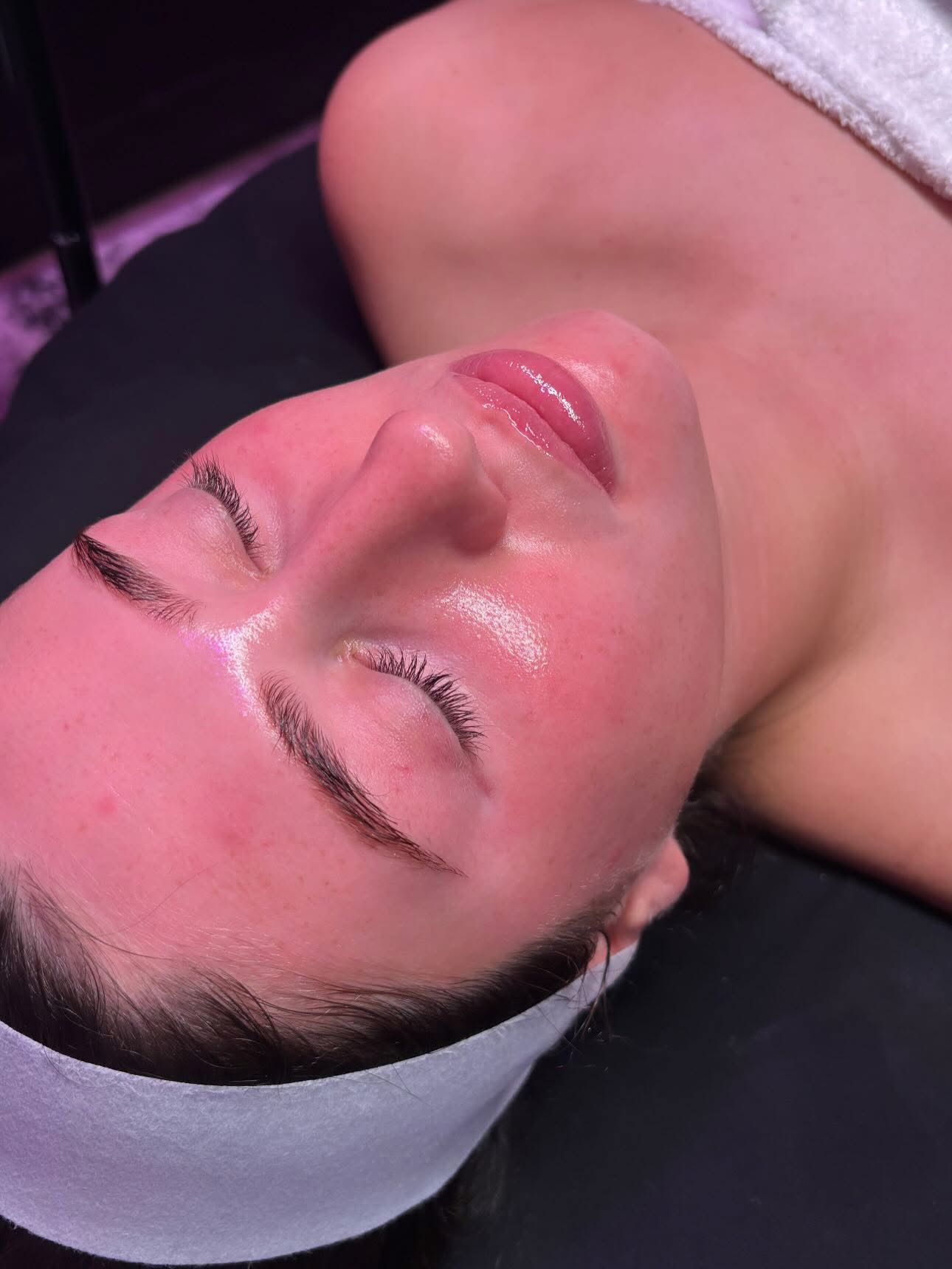 Glowing skin and radiant results from professional facial treatment